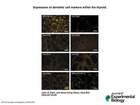 Expression of dendritic cell markers within the thyroid.