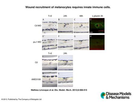 Wound recruitment of melanocytes requires innate immune cells.