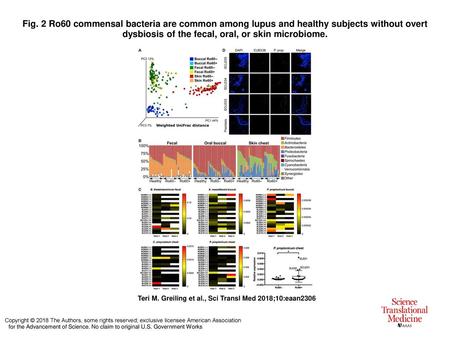 Fig. 2 Ro60 commensal bacteria are common among lupus and healthy subjects without overt dysbiosis of the fecal, oral, or skin microbiome. Ro60 commensal.