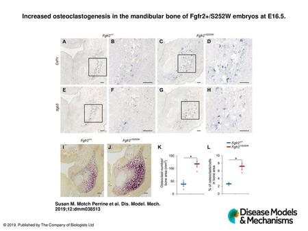 Increased osteoclastogenesis in the mandibular bone of Fgfr2+/S252W embryos at E16.5. Increased osteoclastogenesis in the mandibular bone of Fgfr2+/S252W.