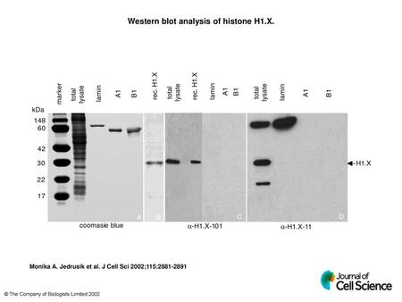 Western blot analysis of histone H1.X.