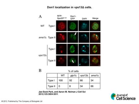 Don1 localization in vps13Δ cells.