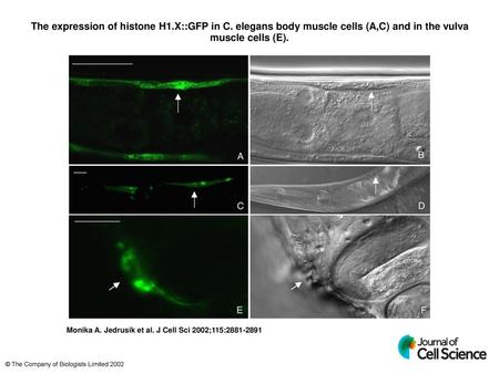 The expression of histone H1. X::GFP in C