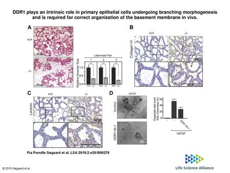 DDR1 plays an intrinsic role in primary epithelial cells undergoing branching morphogenesis and is required for correct organization of the basement membrane.