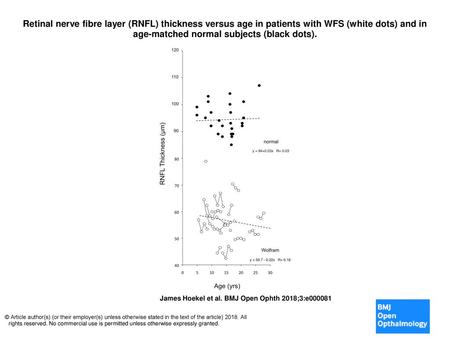 Retinal nerve fibre layer (RNFL) thickness versus age in patients with WFS (white dots) and in age-matched normal subjects (black dots). Retinal nerve.