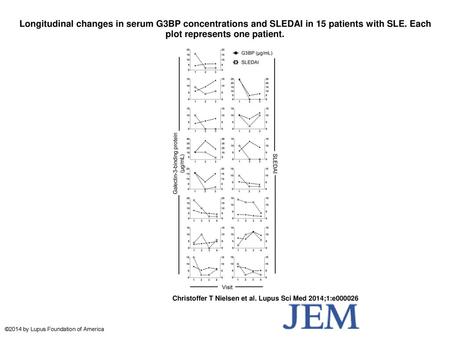 Longitudinal changes in serum G3BP concentrations and SLEDAI in 15 patients with SLE. Each plot represents one patient. Longitudinal changes in serum G3BP.