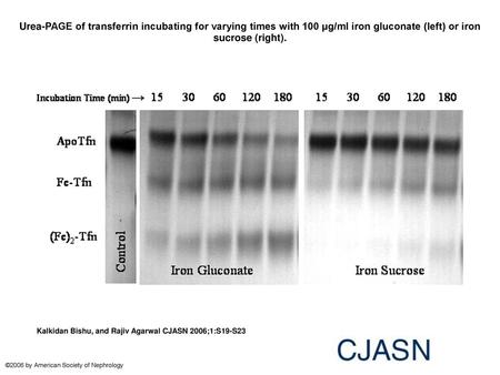 Urea-PAGE of transferrin incubating for varying times with 100 μg/ml iron gluconate (left) or iron sucrose (right). Urea-PAGE of transferrin incubating.