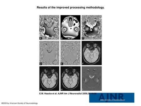 Results of the improved processing methodology.