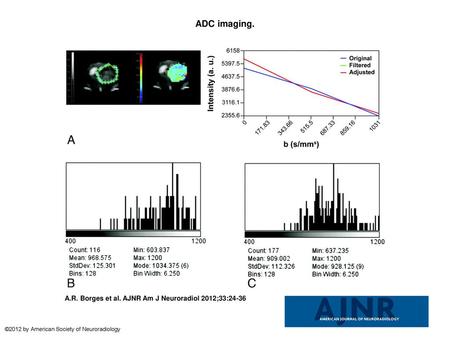 ADC imaging. ADC imaging. A, Delineation of the ROI (left, green limits), intensity versus b value graph of a representative pixel (right), and a parametric.