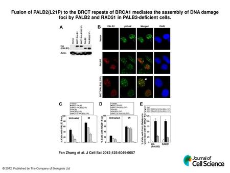 Fusion of PALB2(L21P) to the BRCT repeats of BRCA1 mediates the assembly of DNA damage foci by PALB2 and RAD51 in PALB2-deficient cells. Fusion of PALB2(L21P)