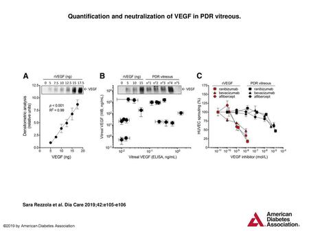 Quantification and neutralization of VEGF in PDR vitreous.