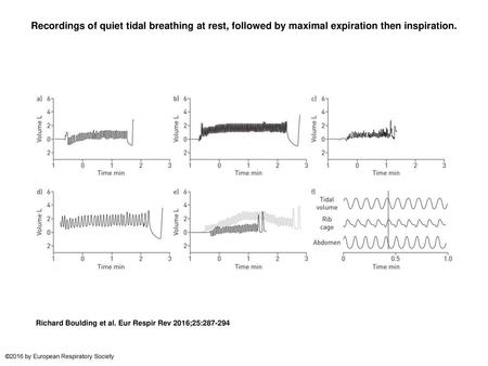 Recordings of quiet tidal breathing at rest, followed by maximal expiration then inspiration. Recordings of quiet tidal breathing at rest, followed by.