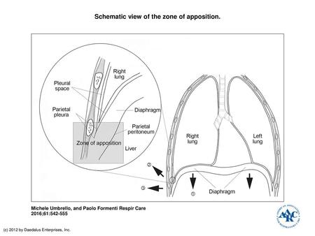 Schematic view of the zone of apposition.