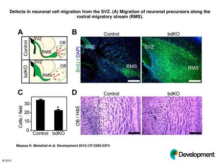 Defects in neuronal cell migration from the SVZ