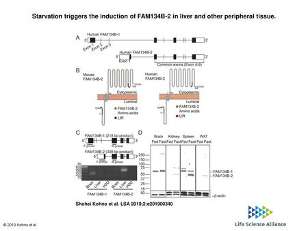 Starvation triggers the induction of FAM134B-2 in liver and other peripheral tissue. Starvation triggers the induction of FAM134B-2 in liver and other.