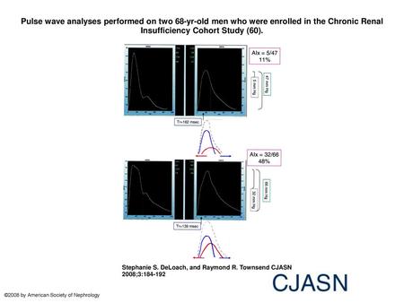 Pulse wave analyses performed on two 68-yr-old men who were enrolled in the Chronic Renal Insufficiency Cohort Study (60). Pulse wave analyses performed.