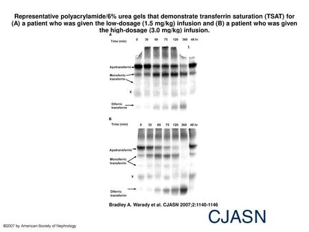 Representative polyacrylamide/6% urea gels that demonstrate transferrin saturation (TSAT) for (A) a patient who was given the low-dosage (1.5 mg/kg) infusion.