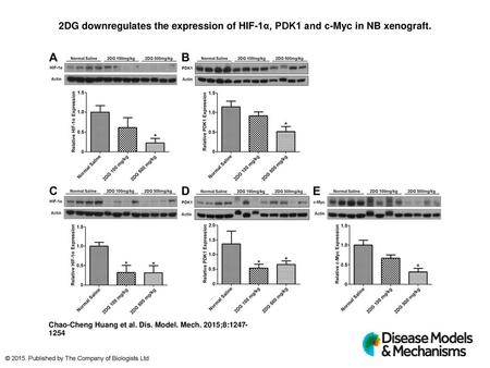 2DG downregulates the expression of HIF-1α, PDK1 and c-Myc in NB xenograft. 2DG downregulates the expression of HIF-1α, PDK1 and c-Myc in NB xenograft.