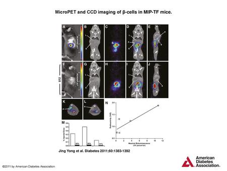 MicroPET and CCD imaging of β-cells in MIP-TF mice.