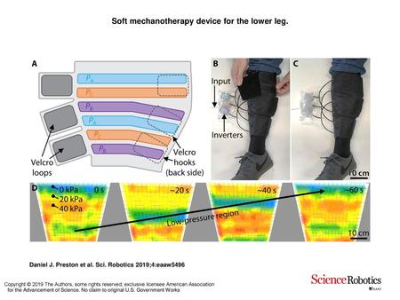 Soft mechanotherapy device for the lower leg.