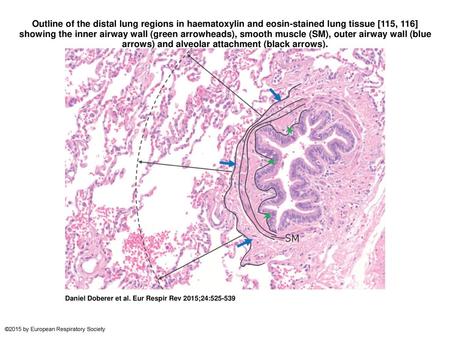 Outline of the distal lung regions in haematoxylin and eosin-stained lung tissue [115, 116] showing the inner airway wall (green arrowheads), smooth muscle.