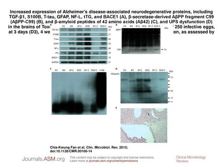 Increased expression of Alzheimer's disease-associated neurodegenerative proteins, including TGF-β1, S100B, T-tau, GFAP, NF-L, tTG, and BACE1 (A), β-secretase-derived.