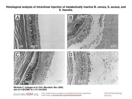 Histological analysis of intravitreal injection of metabolically inactive B. cereus, S. aureus, and E. faecalis. Histological analysis of intravitreal.