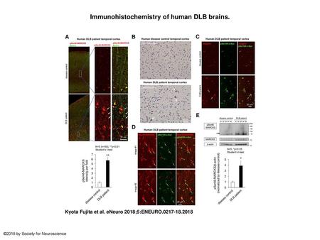 Immunohistochemistry of human DLB brains.