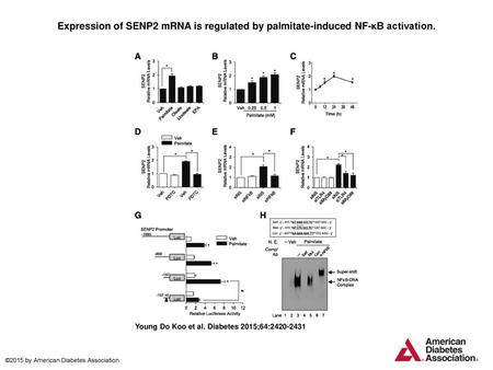 Expression of SENP2 mRNA is regulated by palmitate-induced NF-κB activation. Expression of SENP2 mRNA is regulated by palmitate-induced NF-κB activation.