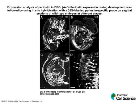 Expression analysis of periostin in DRG