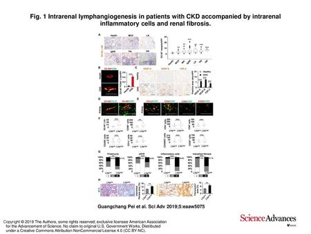 Fig. 1 Intrarenal lymphangiogenesis in patients with CKD accompanied by intrarenal inflammatory cells and renal fibrosis. Intrarenal lymphangiogenesis.