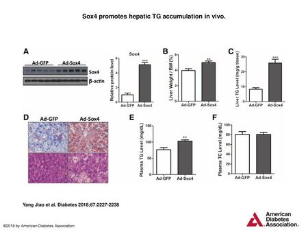 Sox4 promotes hepatic TG accumulation in vivo.