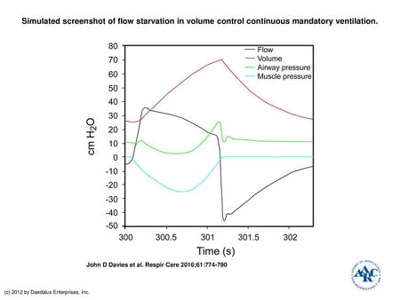 Simulated screenshot of flow starvation in volume control continuous mandatory ventilation. Simulated screenshot of flow starvation in volume control continuous.