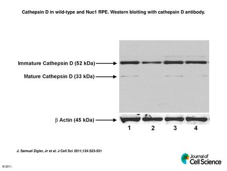 Cathepsin D in wild-type and Nuc1 RPE