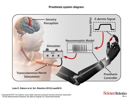 Prosthesis system diagram.