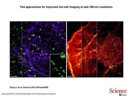 Two approaches for improved live-cell imaging at sub-100-nm resolution