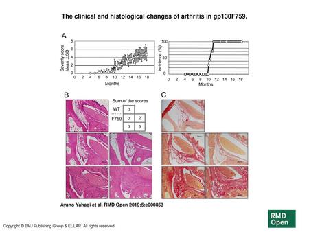 The clinical and histological changes of arthritis in gp130F759.