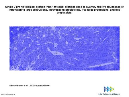 Single 2-μm histological section from 140 serial sections used to quantify relative abundance of intravasating large protrusions, intravasating proplatelets,