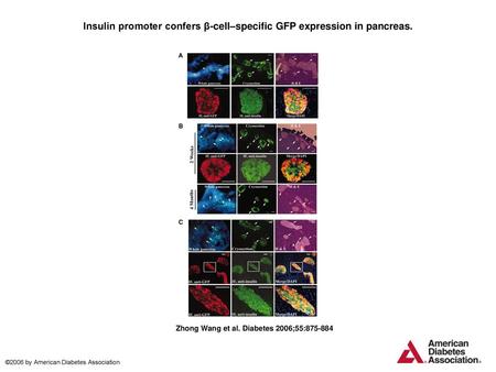 Insulin promoter confers β-cell–specific GFP expression in pancreas.