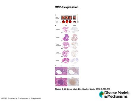 MMP-9 expression. MMP-9 expression. (A) Lungs from M. tuberculosis-infected (H37Rv, 14 wpi, untreated) and age-matched uninfected (control) mice were harvested.