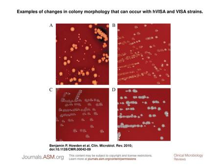 Examples of changes in colony morphology that can occur with hVISA and VISA strains. Examples of changes in colony morphology that can occur with hVISA.