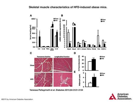 Skeletal muscle characteristics of HFD-induced obese mice.