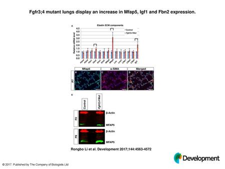 Fgfr3;4 mutant lungs display an increase in Mfap5, Igf1 and Fbn2 expression. Fgfr3;4 mutant lungs display an increase in Mfap5,Igf1and Fbn2 expression.