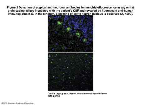 Figure 2 Detection of atypical anti-neuronal antibodies Immunohistofluorescence assay on rat brain sagittal slices incubated with the patient's CSF and.