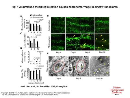 Fig. 1 Alloimmune-mediated rejection causes microhemorrhage in airway transplants. Alloimmune-mediated rejection causes microhemorrhage in airway transplants.