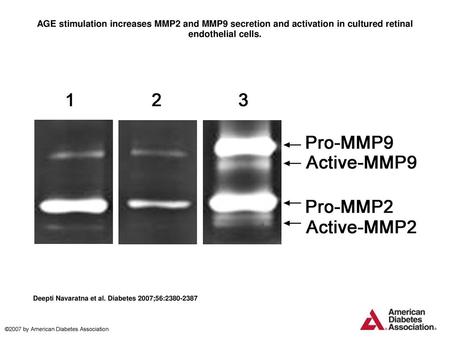 AGE stimulation increases MMP2 and MMP9 secretion and activation in cultured retinal endothelial cells. AGE stimulation increases MMP2 and MMP9 secretion.