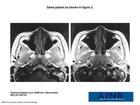 Same patient as shown in figure 3.