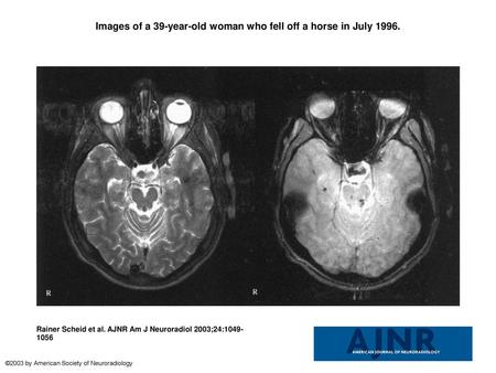 Images of a 39-year-old woman who fell off a horse in July 1996.