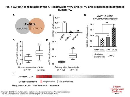 Fig. 1 AVPR1A is regulated by the AR coactivator VAV3 and AR-V7 and is increased in advanced human PC. AVPR1A is regulated by the AR coactivator VAV3 and.