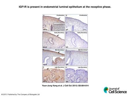 IGF1R is present in endometrial luminal epithelium at the receptive phase. IGF1R is present in endometrial luminal epithelium at the receptive phase. Endometrial.